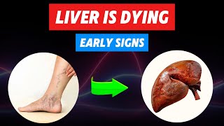 Prevent Liver Damage: 9 Early Signs You Need to Know!