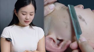 💈ASMR | Remove tons of willow-like fuzz from a man's face. 🪒Shaving the face and head!