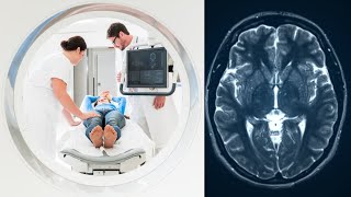 CT Scan - Everything You Need To Know About Computed Tomography