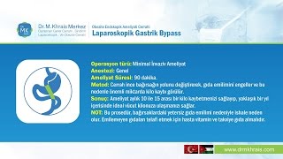 Laparoskopik Gastrik Bypass