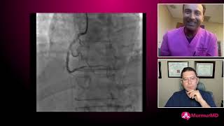 Calcified complex STEMI lesion, and using IVL in ACS with Dr. Lichaa and Dr. Narula #cardiology