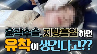 윤곽수술, 지방흡입 후 생긴 유착을 해결하고 싶다면?