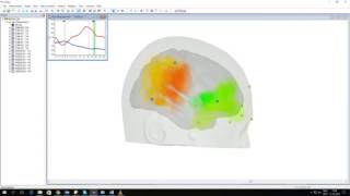 Combining multiple Artinis fNIRS devices