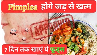 Pimples होगे जड़ से खत्म 7 दिन तक खाएं ये फूड्स| 7 Days Anti Acne Diet Plan for Pimple Removal