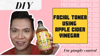 DIY FACIAL TONER USING APPLE CIDER VINEGAR FOR PIMPLE CONTROL | mike88 vlogs