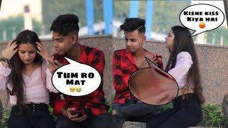 Hickey ( Love bite ) 💋 !! Prank On Bestfriend 😂  !! Abid 09