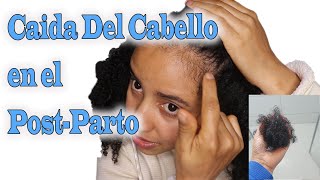 CAÍDA DE CABELLO EN EL POSTPARTO  ¿ Cuánto dura? ¿Es normal?