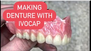 Making dentures with ivocap- all the steps #waxbae #ivocap