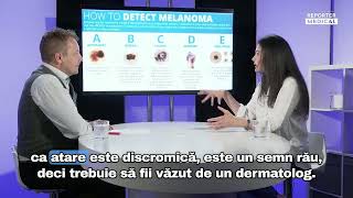 Autoexaminarea te ajută să descoperi cancerul de piele la timp - Regula ABCDE