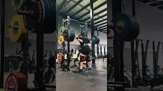 190kg / 418lbs Squat PR with Fused Spine (L5-S1)