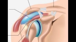 Natural Treatments for Rotator Cuff Pain