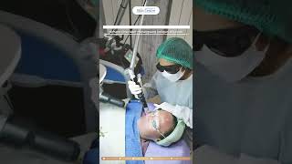 Laser treatment by Pico Laser Surabaya SKin Centre