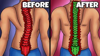 This Will Fix Your Posture In 30 Days!