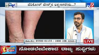 Nimma Doctor | Treatment For Varicose Veins | Homeocare International (08-04-2023)