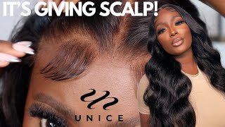 REAL PRE-BLEACHED WIG! IT'S GIVING SCALP! | BYE BYE KNOTS WIG FT UNICE HAIR