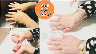 لو ايديك تبارك من غسيل المواعين يبقى الفيديو ده لك ورحمي يديك شويه