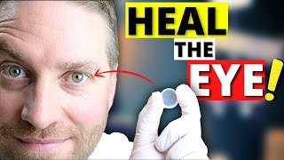 Amniotic Membrane For Dry Eye (And More AMAZING Eye Healing Properties!)