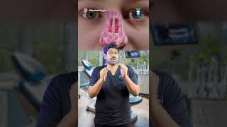 வாய் வழியாக மூச்சு விடுவதை தடுப்பது எப்படி? -How to Stop Mouth Breathing Habit? |Denta Kings #shorts