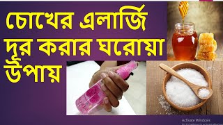 EYE Allergy - চোখের এলার্জি দূর করার ঘরোয়া উপায় // এলার্জির লক্ষণ