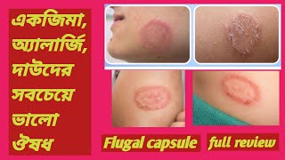 Eczema treatment. একজিমা, অ্যালার্জি, দাউদের সবচেয়ে ভালো ঔষধ।