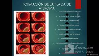 Cardiopatía isquémica I - AngioCardiología - sem 6