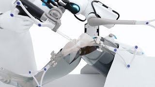 Knee replacement surgery VELYS Robotic-Assisted Solution