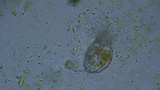 Bacteria are Eating a Dead Rotifer