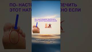 натоптошы и правильные способы их убрать #анатомия #здоровье #натоптыши #мазоль #другаялогика