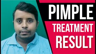 Best Pimple Treatment Testimonials: Real Stories, Real Results! Sakhiya Skin clinic Review