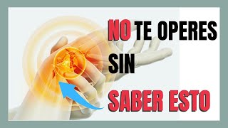 🧨OPERACIÓN del SINDROME DEL TUNEL CARPIANO ¿Es NECESARIA? Primero debes conocer ESTO✅