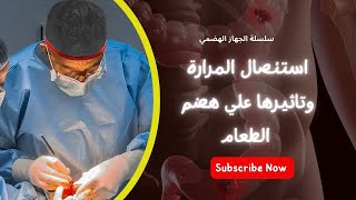 استئصال المرارة وتاثيرها علي هضم الطعام#الجهاز_الهضمي #النادي-الجراحي