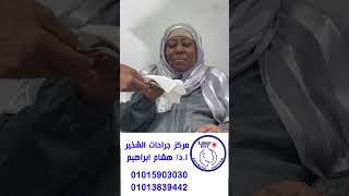 الحاجة نوال من السودان.. مافيش اسهل من الدعامه .. حاجة ماكنت اتخيلها ابدا والنفس حلو..شكرا يا دكتور