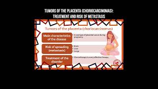 The tumors of placenta (choriocarcinoma): treatment and risk of metastasis #tumor #placenta #cancer