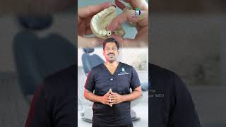 இம்பிளான்ட்/கேப் ஆடுகிறதா? - Mobility of Dental Implant/Cap | Dr. Karthikeyan | Denta Kings