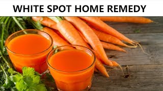 WHITE SPOTS on Skin Natural Home Remedy | Trunky