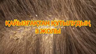 Қайызғақтан құтылудың 3 жолы. Кайызгактан калай кутылуга болады?