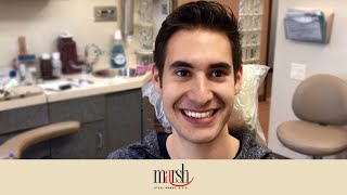 Straighter Teeth Without Braces | How We Do It | Dr. Steve Marsh