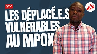 RDC : les déplacé·e·s vulnérables au MPOX