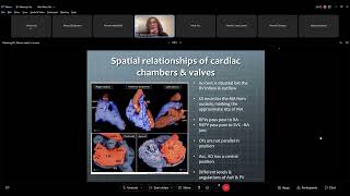 Cardiac anatomy for the electrophysiologistВу Dr. Rania Samir