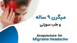 درمان میگرن 9 ساله با طب سوزنی ------  Acupuncture for Migraine Headache