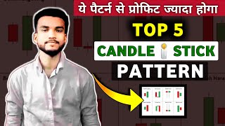 Top 5 Most Powerful candle stick pattern सब trader इस पैटर्न को फॉलो करते है By Ranjit Karmakar