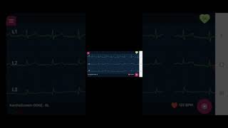 VitaCuro - Update ECG Record