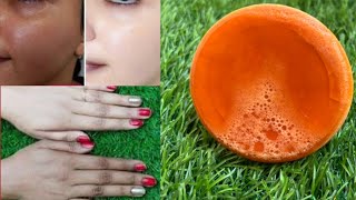 🔥Skin Whitening Soap/ Remove Dark Spot, Pigmentation, Wrinkles,suntanning