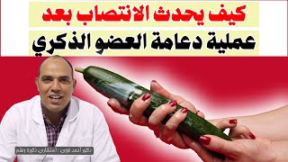 كل ماتحتاج معرفته حول دعامة الانتصاب وتأثيرها الفعال على العضو الذكري