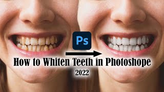 How to clean teeth in photoshop | Teeth whiten tutorial | photoshop tips