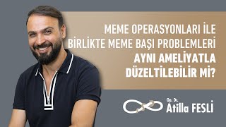 Meme Operasyonları İle Birlikte Meme Başı Problemleri Aynı Ameliyatla Düzeltilebilir Mi?