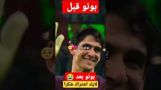 بونو قبل و بونو بعد |#short