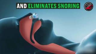 Anti Snore Clip from GRAVITY-Z