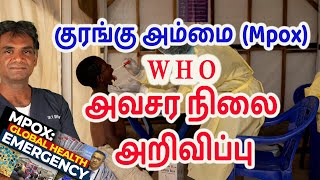 Monkey Pox Outbreak 2024 - WHO Declares Emergency - What You Need To Know - Dr.P.Sivakumar -In Tamil