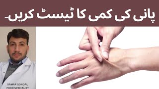 How to check dehydration in the body | Skin turgor test | Pinch test | پانی کی کمی کا ٹیسٹ کریں